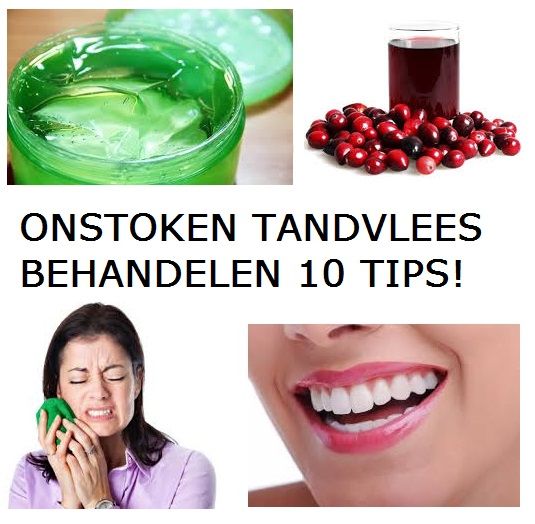 Ontstoken Tandvlees Spoelen Tips Let Op Vogels